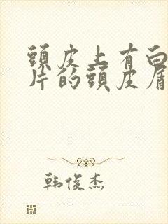 头皮上有白色大片的头皮屑怎么办