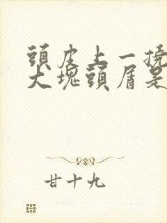 头皮上一挠就一大块头屑是怎么回事封面