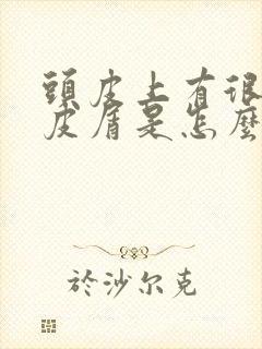 头皮上有很多头皮屑是怎么回事