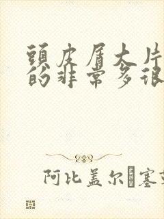 头皮屑大片大片的非常多很痒怎么办封面