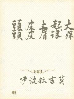 头皮上起大片的头皮屑很痒怎么回事