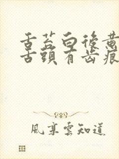 舌苔白后黄腻,舌头有齿痕