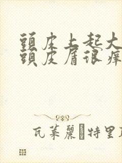 头皮上起大片的头皮屑很痒怎么回事