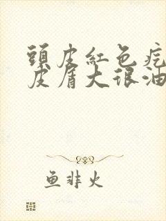 头皮红色疙瘩头皮屑大很油