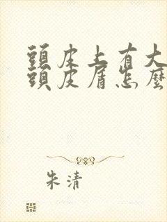 头皮上有大块的头皮屑怎么回事