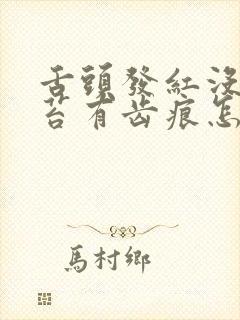 舌头发红没有舌苔有齿痕怎么调理