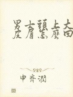 男士头上大片头皮屑怎么回事