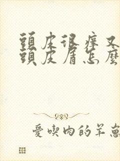 头皮很痒又没有头皮屑怎么回事