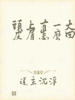 头上有一大块头皮屑怎么回事