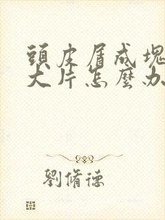 头皮屑成块状一大片怎么办