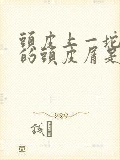 头皮上一坨一坨的头皮屑是怎么回事