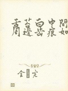 舌苔白中间裂纹周边齿痕如何调理