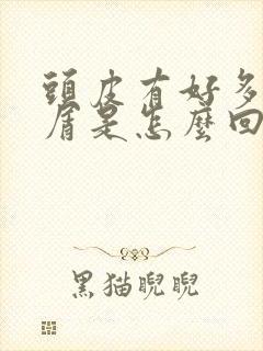 头皮有好多头皮屑是怎么回事