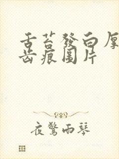 舌苔发白厚腻有齿痕图片