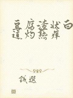 豆腐渣状白带阴道灼热痒