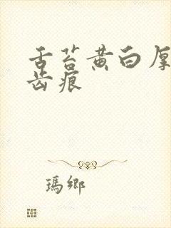 舌苔黄白厚腻有齿痕