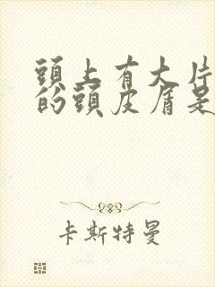 头上有大片白色的头皮屑是什么原因