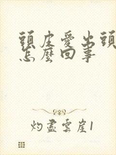 头皮爱出头皮屑怎么回事