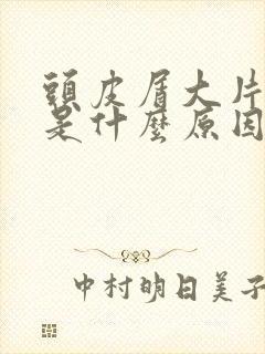 头皮屑大片脱落是什么原因