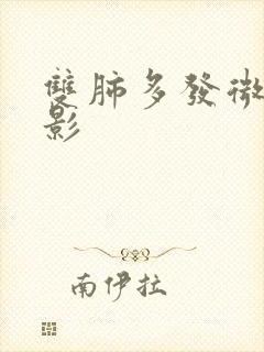 双肺多发微小节影