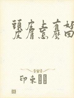 头皮上有好多头皮屑怎么回事