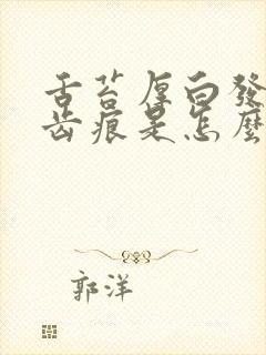 舌苔厚白发黄有齿痕是怎么回事