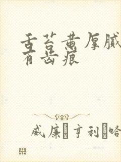 舌苔黄厚腻两侧有齿痕封面