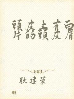 头皮上有白色大片的头皮屑是怎么回事