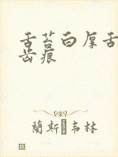 舌苔白厚舌边有齿痕