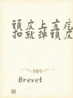 头皮上有疙瘩一扣就掉头皮屑