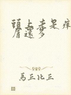 头上老是痒头皮屑还多