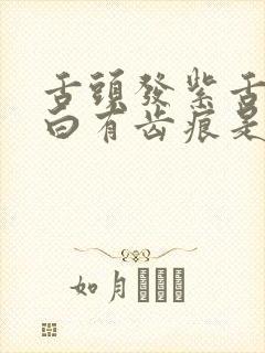 舌头发紫舌苔厚白有齿痕是怎么回事