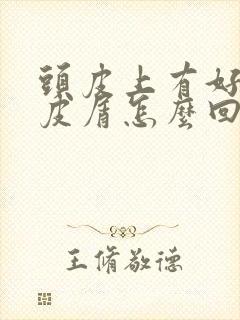 头皮上有好多头皮屑怎么回事