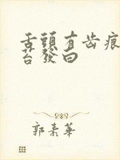 舌头有齿痕,舌苔发白