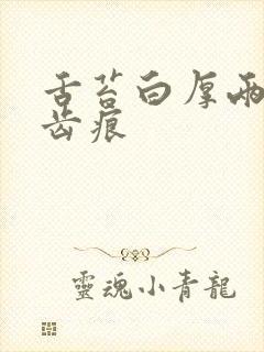 舌苔白厚两侧有齿痕封面