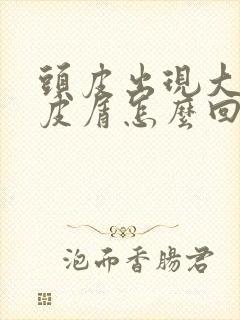 头皮出现大片头皮屑怎么回事