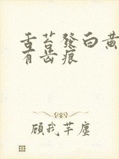 舌苔发白黄厚腻有齿痕