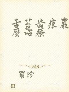 舌苔齿痕严重怎么治疗