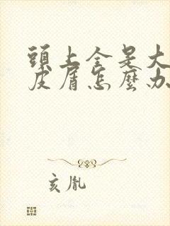 头上全是大片头皮屑怎么办