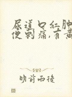 尿道口红肿,小便刺痛,有黄色分泌物