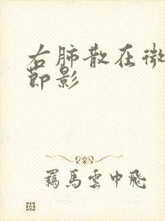 右肺散在微小结节影