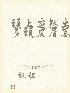 头上突然出现很多头皮屑怎么回事