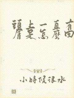 头上一直有头皮屑是怎么回事封面