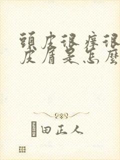 头皮很痒很多头皮屑是怎么治疗