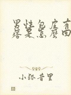 男性包皮有小疙瘩是怎么回事封面