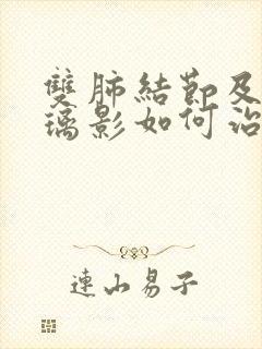 双肺结节及磨玻璃影如何治疗