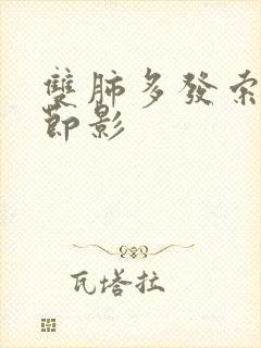 双肺多发索条结节影