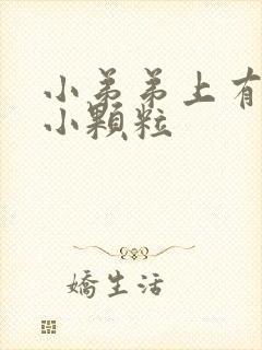 小弟弟上有白色小颗粒封面