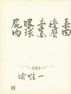 屁眼旁边长一个肉球怎么回事封面