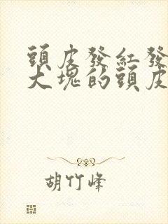 头皮发红发痒有大块的头皮屑是怎么回事